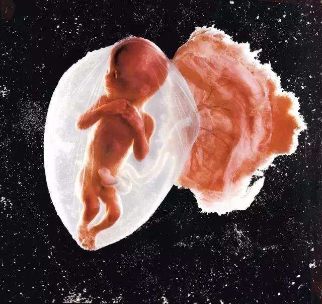 「十八周的胎儿 fetus,    weeks」